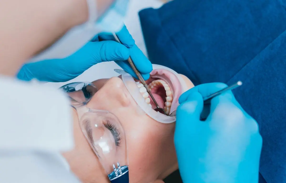 Maseaua de minte exractie - chirurgie orala Galati