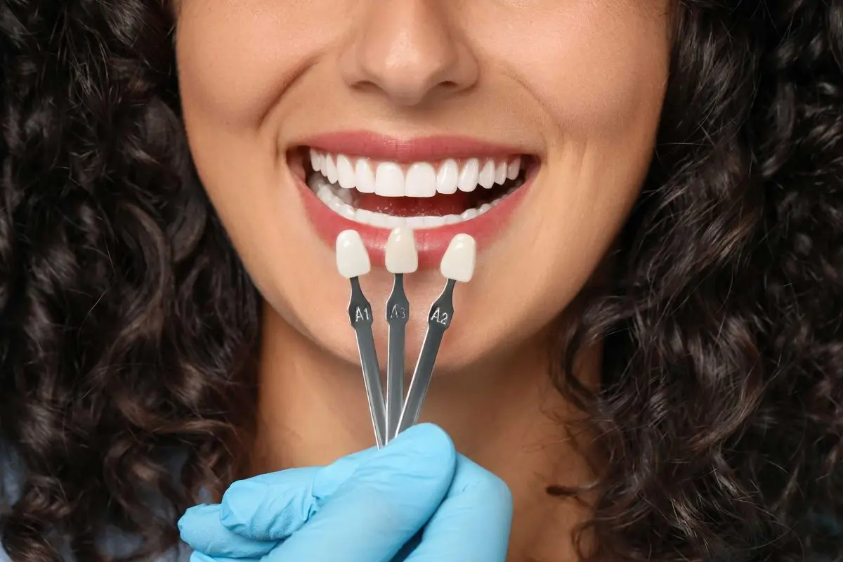 fatete dentare Galati - estetica dentara Galati - clinica Onlysmile