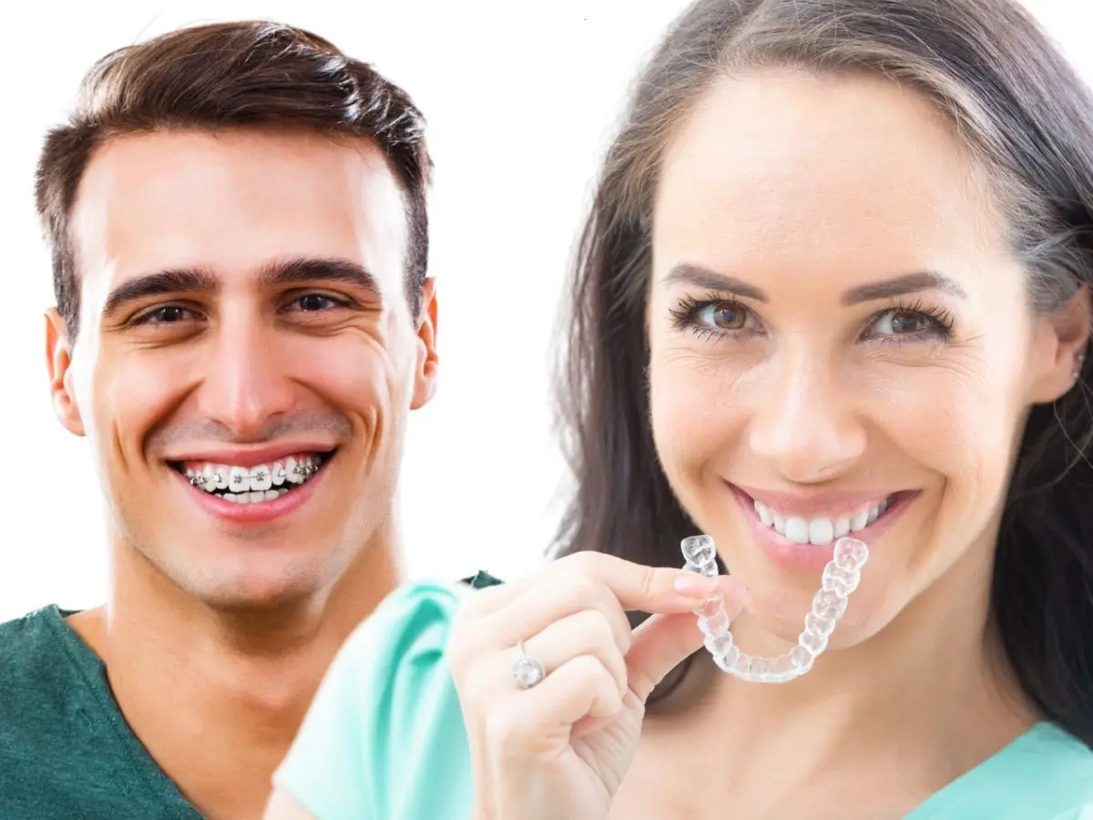 aparat Invisalign Galati: aparat dentar Galati