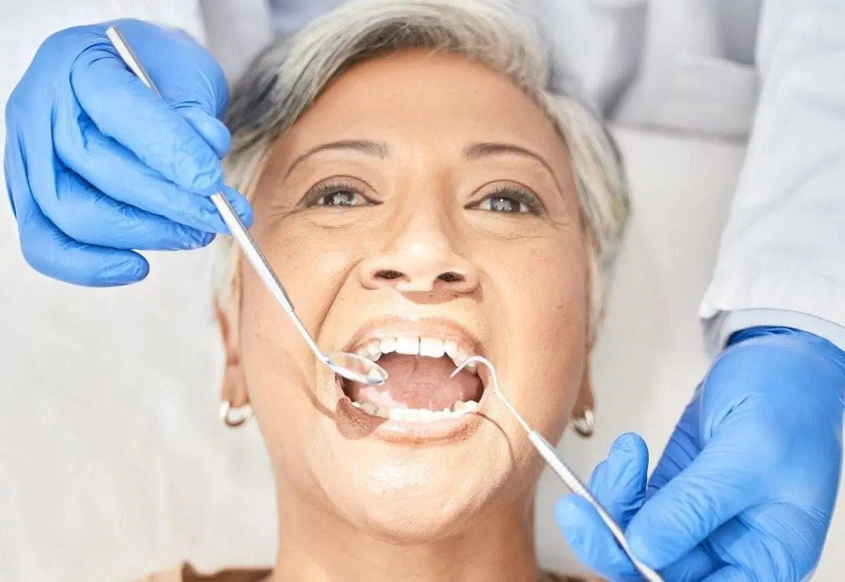 protetica dentara Galati: proteza dentara Galati coroana dntara Galati fatete dentare dinti zirconiu